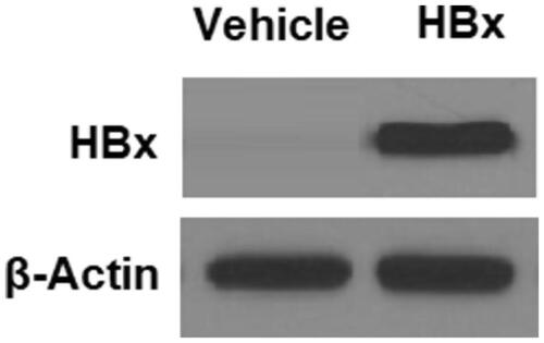 Figure 1. Determination of HBx expression in hepatocytes. HBx-encoding plasmids were transfected into L-02 hepatocytes for 48 h. Western blot analysis revealed the overexpression of HBx in normal human L-02 hepatocytes.