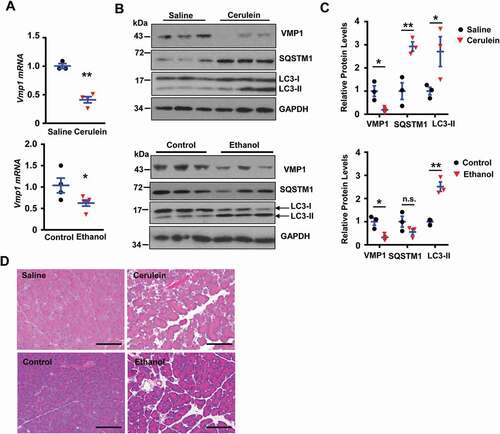 Figure 2. Decreased VMP1 expression in experimental AP mouse models. (A) Immunoblotting analysis using total lysates from pancreatic tissues. (B) Pancreatic mRNA was extracted followed by qPCR analysis. Results were normalized to Rn18s and expressed as fold change compared to control group. Data shown are mean ± SE (n = 3–5). *p < 0,05; **p < 0,01; Student t-test analysis. (C) Representative images of H&E staining from either cerulein or ethanol-induced AP mouse pancreatic tissues are shown. Bar: 100 µm.