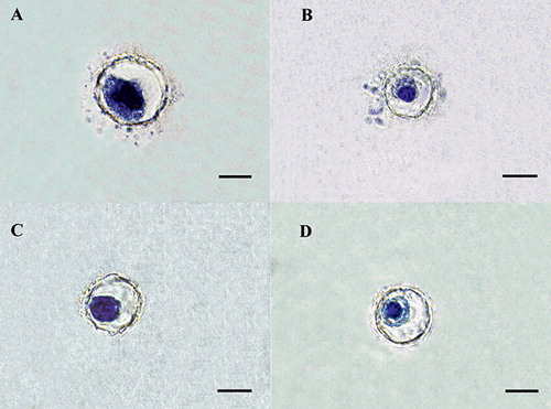 Figure 8.  Effects of dynamic compressive loading in combination with growth factor. Histological appearance of cells treated with: A. bFGF but no mechanical stress, B. BMP-2 but no mechanical stress, (C) bFGF and mechanical stress, and (D) BMP-2 and mechanical stress. Toluidine blue staining. The oval cell body and the ECM area in the “stress control” (growth factor but no mechanical stress, corresponding to panels A and B) were generally larger than in each study group (corresponding to panels C and D). Scale bars: 10 µm.
