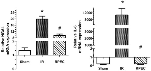 Figure 2. Effects of RPEC on renal NGAL and IL-6 gene expression. I/R, ischemia/reperfusion group; RPEC, remote perconditioning group; each column and bar represents the mean ± SEM (n = 5 in each group). *p< 0.05 compared with the sham group; #p< 0.05 compared with the I/R.