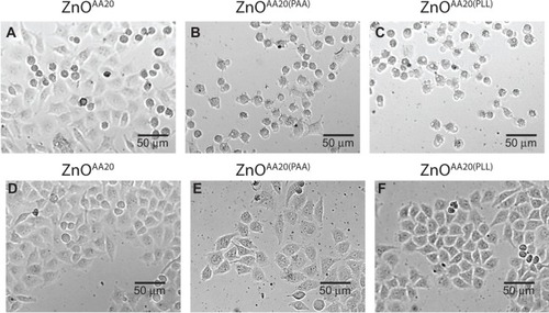 Figure 6 Optical images of HeLa cells exposed to (A) ZnOAA20, (B) ZnOAA20(PAA), and (C) ZnOAA20(PLL), in DMEM without FBS; and (D) ZnOAA20, (E) ZnOAA20(PAA), and (F) ZnOAA20(PLL), in DMEM with FBS.Notes: Exposed concentration of ZnO; 20 mg/L.Abbreviations: FBS, fetal bovine serum; DMEM, Dulbecco’s Modified Eagle’s Medium; ZnOAA20, 20 nm ZnO; ZnOAA20(PAA), poly(acrylic acid)-coated, 20 nm ZnO; ZnOAA20(PLL), poly-L-lysine hydrochloride–coated, 20 nm ZnO.