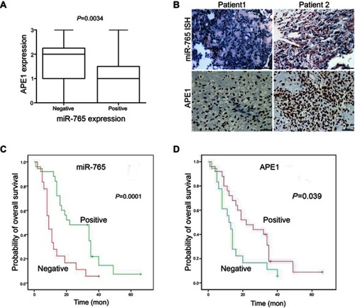 Figure 5 Clinical validation of miR-765 and APE1. (A) APE1 and miR-765 expression are inversely correlated in osteosarcoma samples. Patients were divided equally into two groups according to miR-765 expression level, and APE1 expression showed considerable differences between the miR-765 low and miR-765 high groups (p=0.0034, Mann–Whitney U test). (B) Paraffin-embedded, formalin-fixed osteosarcoma cancer tissues were incubated with a locked nucleic acid anti-miR-765 probe for in situ hybridization (ISH) and anti-APE1 antibody for immunohistochemical (IHC) analysis with scrambled probe and phosphate-buffered saline as negative controls, respectively. Representative photographs are shown. Scale bars =50 μm. (C and D) A Kaplan–Meier analysis of overall survival for osteosarcoma patients with the corresponding expression profiles of APE1 (D) and miR-765 (C) is shown (p=0.039 and p=0.001, respectively, log-rank test).