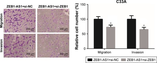 Figure 6 Knockdown of ZEB1 abrogates the oncogenic role of ZEB1-AS1 in CC cells.