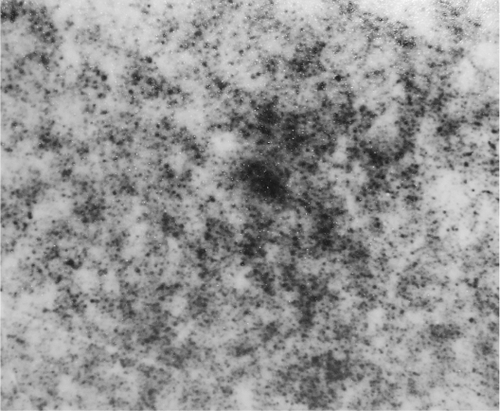 Figure 1 Transmission electron micrograph of magnetic iron oxide (Fe3O4)-dextran-anti-β-HCG nanoparticles.Abbreviations: HCG, human chorionic gonadotropin.