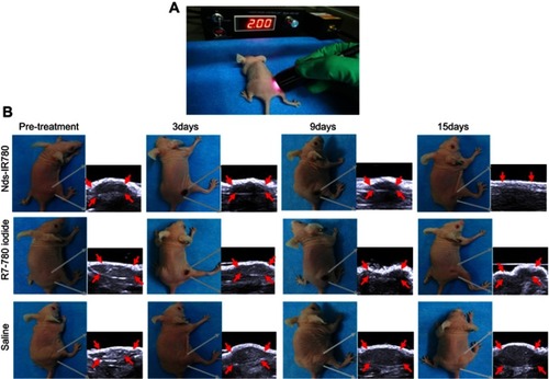 Figure 9 The photothermal treatment of CMM mediated by Nds-IR780 in vivo. (A) The photothermal treatment procedure for CMM by laser at 808 nm. (B) Tumor volume monitoring by two-dimensional ultrasound before and after treatment.