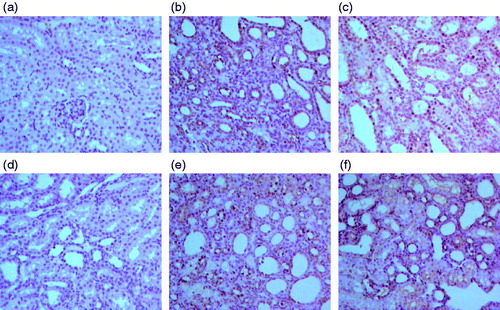Figure 7. Effect of resveratrol on renal tubular epithelial cell apoptosis index in UUO rats. The tissue sections from different groups were stained with TUNNEL staining and observed under light microscope at 400× magnification. Panel a represents sham group; panel b represents model group; panel c represents enalapril group; panel d represents high-dose resveratrol group; panel e represents middle-dose resveratrol group and panel f represents low-dose resveratrol group.