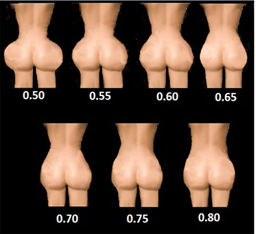 Figure 5 Posterior view with varying WHRs in women. Reproduced from Nteli Chatzioglou G, Govsa F, Bicer A, Ozer MA, Pinar Y. Physical attractiveness: analysis of buttocks patterns for planning body contouring treatment. Surgical and radiologic anatomy: SRA. 2019;41(1):133–140, Springer Nature.Citation61