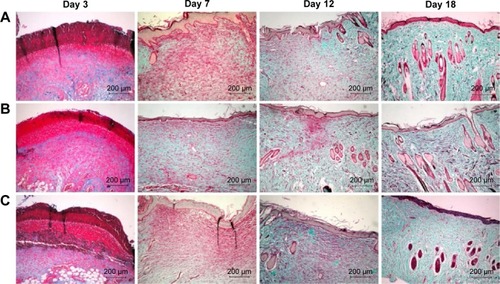 Figure 3 Masson’s trichome staining of biopsies of rat skin tissue.Notes: Collagen is stained blue-green, while cytoplasm, red blood cells, and nuclei are stained red. Masson-trichrome staining of collagen at day 3, 7, 12, 18 post-wounding: (A) gauze, (B) PVA/COS-AgNPs nanofiber, (C) PVA/COS-AgNPs nanofiber plus SB431542.