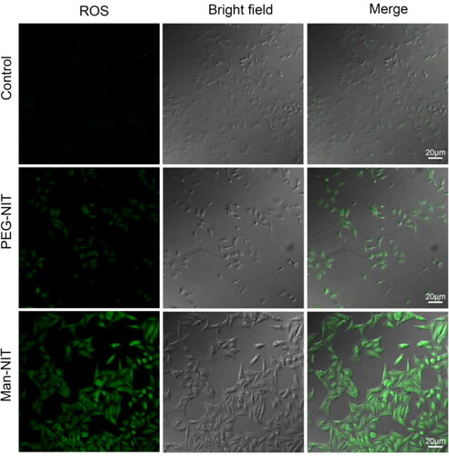 Figure 4. ROS fluorescence images in HCCLM3 cells after giving nanomicelles. Scale bar: 20 μm.