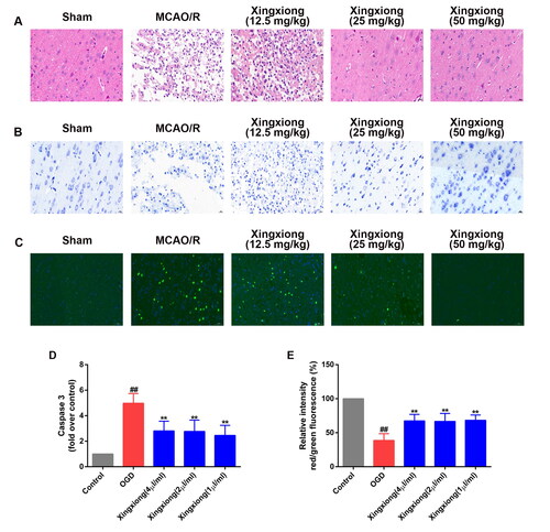 Figure 2. Xingxiong injection reduces neuronal injury and apoptosis of rats with MCAO/R and primary cortical neurons with OGD/R. (A) H&E staining in the cortex region in different groups. Scale bar: 200 μm, n = 3; (B) Nissl staining in the cortex region in different groups. Scale bar: 200 μm, n = 3; (C) immunofluorescence for TUNEL-positive neurons in the cortex, n = 3. Scale bar: 50 μm. (D) Caspase-3 activity of primary cortical neurons with OGD/R was measured using a fluorometric assay. (F) Primary cortical neurons were dyed with JC-1 and then detected using a fluorescence microscope. Data are expressed as the mean ± SD and were analysed by ANOVA. ##p < 0.01 vs. control group; **p < 0.01 vs. OGD/R group.