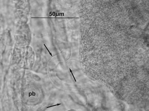 Figure 2 Cernosvitoviella longiducta n. sp. Optical sections of coiled sperm duct (marked by arrows) and a “penial bulb” (pb).