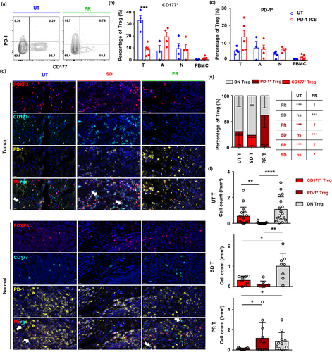 Figure 6. Anti-PD-1 immunotherapy impairs CD177+ Treg and boosts PD-1+ Treg cells in ESCC. (a) Representative flow cytometry result of CD177 and PD-1 expression by tumor Treg cells from surgical samples of untreated patients and patients with a partial response to neoadjuvant anti-PD-1 immunotherapy plus chemotherapy. (b) Statistical analysis of CD177+ Treg cell percentages in tumor tissues, tumor-adjacent tissues, normal esophagus tissues and PBMCs from untreated patients (n = 4) and patients treated with neoadjuvant anti-PD-1 immunotherapy plus chemotherapy (n = 5). (c) Statistical analysis of PD-1+ Treg cell percentages in tumor tissues, tumor-adjacent tissues, normal esophagus tissues and PBMCs from untreated patients (n = 4) and patients treated with neoadjuvant anti-PD-1 immunotherapy plus chemotherapy (n = 4). (d) Multiplexed immunohistochemistry staining of tumor tissues and tumor-adjacent tissues from untreated patients and patients with PR and SD after neoadjuvant anti-PD-1 immunotherapy plus chemotherapy. White arrows indicate CD177+ non-Treg cells which may be granulocytes. (e) Statistical analysis of percentages of different Treg cell subsets in tumor (T) from untreated patients (n = 19) and patients with PR (n = 12) and SD (n = 9) after neoadjuvant anti-PD-1 immunotherapy plus chemotherapy. (f) Cell density of three Treg cell subsets in tumor tissue of ESCC patients among different cohorts, UT, PR and SD. Statistical analysis was performed using Student’s t-test. *p < 0.05, **p < 0.01, ***p < 0.001.