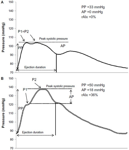 Figure 2 Sample synthesized aortic pressure waves in a person with low pressure attributable to wave reflections (A) and higher pressure from wave reflections (B).