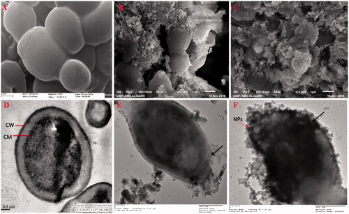 Figure 9. SEM (A–C) and TEM (D–F) of C. albicans. (A and D) Untreated control cells. (B and C) SEM images: cells treated with 0.25 and 0.5 mg/ml of ZnO NPs; illustrating structural deformities and irregular cell shape; (E and F) TEM images: cells treated 0.25 and 0.5 mg/ml of ZnO NPs; showing the attachment and penetration of NPs (red arrow), degradation and destruction of the outer most layers of cell wall and cytoplasmic membrane (black arrow).