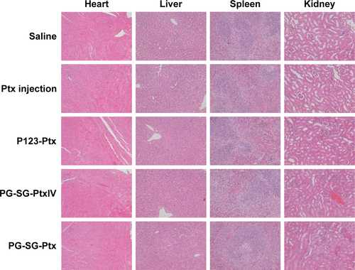 Figure S4 Histopathological analysis of heart, liver, spleen, and kidney of melanoma pulmonary metastatic tumor-bearing male nude mice.Notes: Tissue section isolated on Day 14 after treatments with different Ptx formulations and stained with H&E. Original magnification 20×.Abbreviations: P123, Pluronic P123; Ptx, paclitaxel; PG, P123 modified with GPLGIAGQ-NH2; P123-Ptx, P123 micelles loaded with Ptx; IV, intravenous.