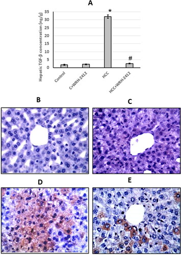 Figure 5. Effect of 5 mg/kg WRH-2412 on TGF-β protein levels (A) as well as liver sections stained with anti- TGF-β antibody in control group (B), control group treated with WRH-2412 (C), HCC group (D) and HCC group treated with WRH-2412 (E). Values are expressed as the mean ± SEM, *p < 0.05 vs. control; #p ≤ 0.05 vs. HCC group. TGF-β: transforming growth factor-β; HCC: hepatocellular carcinoma; C: control.