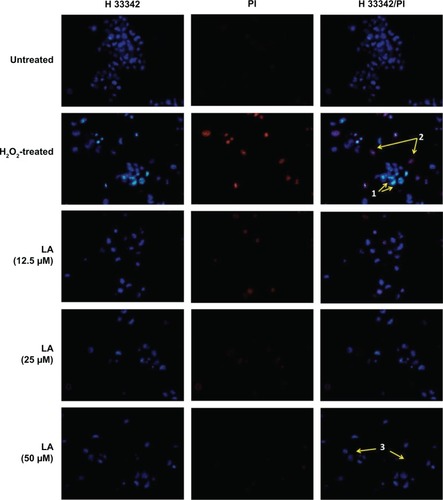 Figure 2 R-LA reduced the H2O2-induced morphological changes in NG108-15 cells.