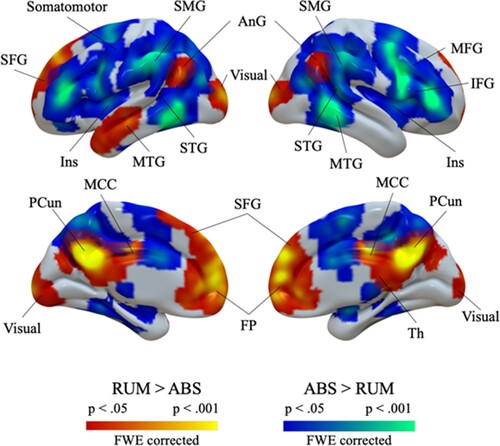 Figure 1. Rumination-related brain activation across all participants. Warm colours indicate stronger activation during rumination; cool colours indicate stronger activation during control condition. Abbreviations: AnG: angular gyrus; FP: frontal pole; Ins: insula; IFG: inferior frontal gyrus; MCC: middle cingulate cortex; MFG: middle frontal gyrus; MTG: middle temporal gyrus; PCun: precuneus; SFG: superior frontal gyrus; SMG: supramarginal gyrus; STG: superior temporal gyrus; Th: thalamus.