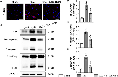 Figure 5 17(R)-Resolvin D1 treatment suppressed the activation of the NLRP3 signalling pathway in the heart. NLRP3 was assessed by immunofluorescence in the LV tissue of each group (n=3) (Scale Bar, 40μm) (A). Protein expressions of apoptosis-associated speck-like protein containing a CARD (ASC), c-caspase-1, procaspase-1, IL-1β, and pro-IL-1β in myocardial tissue were tested by Western blot analysis (B), GAPDH was used as internal control and quantification of the ASC, c-caspase-1, IL-1β level in the indicated groups were analyzed (C–E) (n=4). The data were analyzed using One-way ANOVA followed by Tukey’s post hoc test. Data are presented as the mean ± SEMs. *P < 0.05 compared with the Sham group, #P < 0.05 compared with the TAC group.