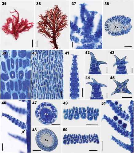 Figs 35–51. Vegetative structures of Spyridia horridula. Fig. 35. Vegetative thallus. Fig. 36. Upper thallus part showing indeterminate branching pattern. Fig. 37. Apex of young thallus. Fig. 38. Cross-section of main axis. Fig. 39. Cortication pattern of indeterminate branches in upper part of thallus. Fig. 40. Cortication pattern of indeterminate branches in middle part of thallus. Figs 41–45. Spine shapes at apex of determinate branches. Fig. 46. Intersection point of determinate branch on main axis lacking cortication (arrow) Figs 47–48. Cross-section of determinate branch. Figs 49–50. Cortication pattern of determinate branches with acropetal filament only. Fig. 51. Determinate branches with tetrasporangia. Scale bars: Fig. 35 = 1 cm; Fig. 36 = 0.5 mm; Figs 37–38, 46 = 50 µm; Figs 39–40, 42–45, 47–50 = 25 µm; Figs 41, 51 = 100 µm; Fig. 32 = 200 µm