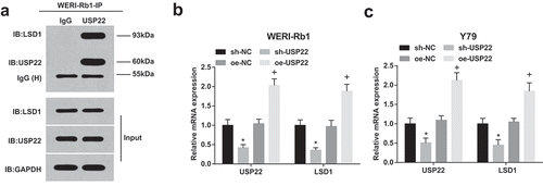 Figure 5. USP22 deubiquitinates LSD1 for protein stabilization in RB. (a), Immunoprecipitation of USP22 in WERI-Rb1 cells with USP22 antibody. (b), USP22 and LSD1 expression in WERI-Rb1 cells by RT-qPCR. (c), USP22 and LSD1 expression in Y79 cells by RT-qPCR.* P < 0.05 vs. sh-NC group. + P < 0.05 vs. oe-NC group. N = 3. Measurement data were depicted as mean ± standard deviation, comparisons among multiple groups were assessed by one-way ANOVA followed with Tukey’s post hoc test