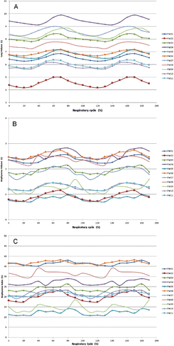 Figure 2. Changes of lung volume (A), emphysema volume (B) and emphysema index (C) over the whole respiratory cycle for each patient. One respiratory cycle (0–90%) was acquired and data were duplicated (100–190%) for better graphical visualization of the respiratory changes.