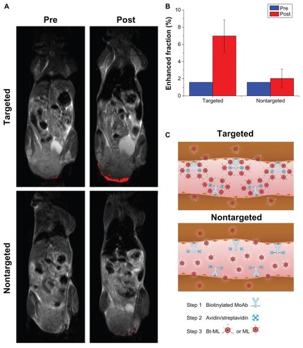 Figure 7 MR detection of the tumors via the anti-αvβ3 antibody guided three-step pretargeting approach. (A) T2-weighted MR images of tumor-bearing mice before and 2 hours after injection of targeted Bt-ML and nontargeted ML, respectively. Enhanced pixels within the tumors were color coded in red. (B) Enhanced fraction of the tumor region before and after 2 hours after injection of contrast agents. (C) Schematic representation of the antibody-guided three-step pretargeting approach.Abbreviations: MR, magnetic resonance; Bt-ML, biotinylated magnetoliposomes; ML, magnetoliposomes.