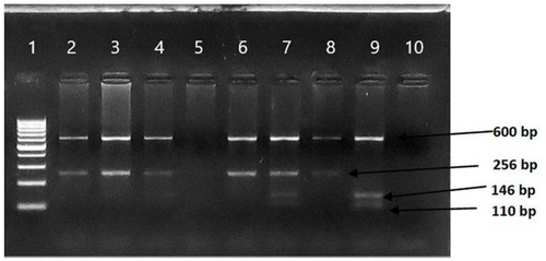 Figure 1 Restriction enzyme analysis of the AT1R gene (A1166C) polymorphism. AA, CC, and AC genotypes are shown.