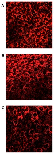 Figure 3 Confocal images of a cross-section of the corneal epithelium at depth of 10 μm after 2 hours of incubation with: (A) Rd-PLGA NS; (B) Rd-PEG-PLGA NSs; (C) Rd-NSs containing 5% (w/v) HPβCD.Abbreviations: HPβCD, hydroxypropyl-β-cyclodextrin; NS, nanospheres; PLGA, Poly(D,L-lactide-co-glycolide); PLGA–PEG, poly(D,L-lactide-co-glycolide) with poly(ethylene glycol); Rd, rhodamine-6G.