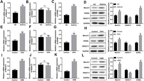 Figure 1 Detection of the expression of March1, HDAC11 and OX40L in asthma. Peripheral blood samples were obtained from asthmatic patients and healthy volunteers, and then DCs were isolated from the serum. Next, (A–C) qRT-PCR was performed to detect the levels of March1 mRNA, HDAC11 mRNA and OX40L mRNA in DCs. (D) Western blot was carried out to detect the expression of March1, OX40L and HDAC11 in DCs. n = 20. *P < 0.05 compared with HC group, and ns was no significant difference. Peripheral blood samples were obtained from asthmatic mice and normal mice, and then DCs were isolated from the serum. Next, (E–G) qRT-PCR was performed to detect the levels of March1 mRNA, HDAC11 mRNA and OX40L mRNA in DCs. (H) Western blot was carried out to detect the expression of March1, OX40L and HDAC11 in DCs. n = 10. *P < 0.05 compared with Control group, and ns was no significant difference. After that, DCs were isolated from the marrow cells of normal mice, and were stimulated with HDM. (I–K) qRT-PCR was performed to detect the levels of March1 mRNA, HDAC11 mRNA and OX40L mRNA in DCs. (L) Western blot was carried out to detect the expression of March1, OX40L and HDAC11 in DCs. n = 3. *P < 0.05 compared with Control group, and ns was no significant difference.