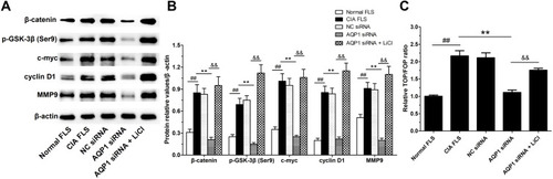 Figure 7 AQP1 siRNA inhibited the activation of β-catenin signaling in CIA FLS. (A) The protein expressions of β-catenin signaling pathway members such as β-catenin, p-GSK-3β (Ser9), c-myc, cyclin D1 and MMP9, detected by Western blot analysis. (B) The quantitative analysis of protein relative values, β-actin serves as house-keeping protein. (C) The ratio of TOP/FOP, an indicator of the activity of TCF/LEF transcription factors. The data are mean ± SEM of three independent experiments performed in triplicate. ##P < 0.01 compared with normal FLS group. **P <0.01 compared with CIA FLS group. &&P < 0.01 compared with AQP1 siRNA group.