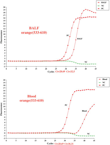 Figure 4 The cycle threshold (Ct) value for mtLSU of BALF and blood detected by PneumoGenius® real-time PCR were 32.5 and 36.31, respectively.