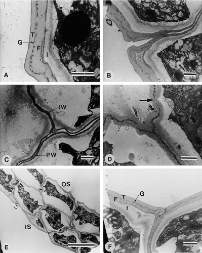 A–F. TEM of Fockea multiflora (Giess & Wiss 3310): (A) Distal wall of outer surface showing tectum (T), granular layer (G), foot layer (F) and intine (I); (B) Distal and proximal walls at joining of tetrads; (C) Proximal walls (PW) between tetrads and inner wall (IW) separating individual grains of a tetrad; (D) Inner walls interrupted by wall bridges (arrow); (E) Part of pollinium showing outer (OS) and inner surface (IS); (F) Distal wall of inner surface showing wall structure (F=foot layer, G=granular layer, I=intine, T=tectum) and continuous wall where tetrads join. Scale bars – 1 μm (in A–D & F) and 10 μm (in E).