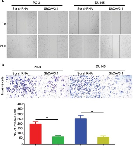 Figure 3 CAV3.1 knockdown suppressed migration and invasion of PCa cells.Notes: (A) CAV3.1 knockdown led to shorter migration distance for PC-3 and DU145 cells. (B) CAV3.1 knockdown led to fewer invasive cells for PC-3 and DU145 cells. **P<0.01. Magnification ×100.Abbreviation: PCa, prostate cancer.