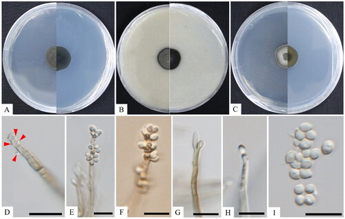 Figure 3. Cultural and morphological characteristics of KNUF-20-NI-005T. The colony growth on potato dextrose agar (A), oatmeal agar (B), and malt extract agar (C) for 14 days of incubation at 25 °C. Conidial structure at different stages of development, resulting in semi-micronematous conidiophores and sympodially proliferating conidiogenous cells (D–F); conidiogenous cells (G, H); conidia (I). Scale bars: D–I = 10 μm. Arrows indicate conidial structure.