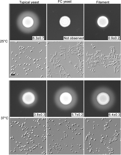Fig. 6 Secreted aspartyl proteinase (SAP) activity of typical yeast, FC yeast, and filamentous C. auris cells.Cells were spotted on YCB-BSA medium (5 × 106 cells) and grown at 25 or 37 °C for 5 days. The width of the white precipitation zone (mm) is reported. Cellular morphologies after 5 days of growth are also shown. Scale bar represents 10 μm
