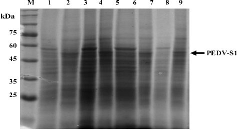 Figure 4. Effect of media on the overexpression of PEDV-S1. Four different rich mediums (nutrient broth, NB; Luria-Bertani, LB; double strength Luria-Bertani, 2 xLB; terrific broth, TB) were tested for optimum expression of PEDV-S1. Lane M, low molecular weight marker; 1, uninduced in NB;2, induced in NB; 3, uninduced in 2 xLB; 4, induced in LB; 5, uninduced in 2 xLB; 6, induced in 2 xLB; 7, uninduced in TB; 8, induced in TB.