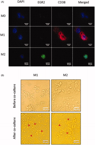 Figure 3. Characterization of polarized macrophages derived from PMA-differentiated THP-1 cells. (A) Immunofluorescence microscopy of PMA-differentiated THP-1 cells (M0 macrophages), macrophages further polarized by IFN-γ and LPS (M1) or by IL-4 (M2). Cells were stained with anti-EGR2 (green) and anti-CD38 (red) and counterstained with DAPI (blue). M1 macrophages (middle row) show high expression of CD38, M2 macrophages (bottom row) show high expression of EGR2, and M0 macrophages (top row) show minimal expression of CD38 or EGR2. (B) Phase contrast microscopy of PMA-differentiated THP-1 cells and polarized M1 (top left and bottom left, red arrow head), and M2 macrophages (top right and bottom right, red arrow head). M1 macrophages appear as large oval-shaped cells whereas M2 macrophages are large and elongated. M1 or M2 macrophages cultured alone (top row) and in co-culture with CLL cells (bottom row), respectively, are shown.
