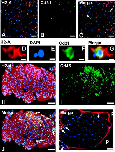 Figure 2. Severe murine experimental autoimmune neuritis in adult female H2-Aaflox/flox; vWF-iCre/+ SJL mice. Representative photomicrographs of axial cryostat 10 µm sciatic nerve sections from sm-EAN-affected adult female wildtype SJL mouse 3 days after disease-onset demonstrates increased MHC class II (H2-A) expression in peripheral nerve endoneurium (A) with some co-localization with Cd31+ endothelium (B and C, white arrows). Higher magnification images of an endoneurial microvessel from the same mouse show mononuclear cell diapedesis associated with H2-A membrane expression (D-G). Diffusely increased MHC class II (H2-A) expression is observed in the endoneurium at sm-EAN peak severity in an adult female Tamoxifen-treated H2-Aaflox/flox; +/+ SJL mouse, associated with Cd45+ leukocyte infiltration (H-J, white arrows). In contrast, an adult female Tamoxifen-treated H2-Aaflox/flox; vWF-iCre/+ SJL mice with microvascular endothelial cell specific MHC class II deletion after Cre-mediated recombination does not develop sm-EAN, with rare Cd45+ leukocytes observed outside the endoneurium (K, white arrows). Increased MHC class II expression is observed in the perineurium (p), as well as lymphoid and non-lymphoid organs (not shown), supporting the notion that microvascular endothelial cell MHC class II expression is necessary for tissue- or organ-specific autoimmunity.