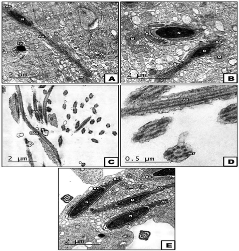 Figure 8. TEM through the sperm of control (A&B), STZ-induced (C&D) and STZ with neem (E) groups. Note: In A&B, the sperm is showing normal structure with spindle-shaped head, axoneme surrounded by mitochondria. In C&D, the sperm is showing remarkable fragmentation in microtubules of axoneme and destructive In E&F, the sperm is showing obvious amelioration in their structure tend to be similar for control X: 5000