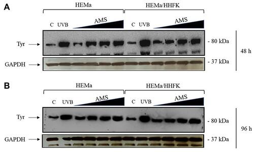 Figure 3 Tyrosinase (Tyr) expression study by immunodetection analysis in HEMa and HEMa-HHFK co-cultures incubated for 48 (A) and 96 h (B) with different concentrations of AMS supplement (0.5, 1, 2, and 3 mg/mL) or irradiated by UVB under controlled conditions. Membranes were incubated with 1:250 monoclonal tyrosinase antibody. Images are representative of four independent experiments and are cropped from original blots, as explicit by using clear delineation with dividing lines and white space (original acquisitions for Western blot experiments are shown in Figure S1). The anti-GAPDH antibody was used to standardize the amounts of proteins in each lane.