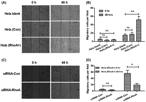Fig. 5. Rho promotes CC cell migration.Notes: (A) and (B) higher migration of Hela, Hela (RhoA+) cells than Hela (Con) cells. Migration of cells was depicted post inoculation at 0, or 48 h by cells scratch assay. Solid lines showed the edges at the start of experiments. (C) and (D) inhibition by siRNA-RhoA, of the promotion of RhoA to the Hela cell migration. Migration of Hela (RhoA+) cells was depicted post transfecting with siRNA-RhoA or siRNA-Con at 0, or 48 h by cells scratch assay. The experiments were performed separately in triplicate. Statistical significant was showed as *p < 0.05 and **p < 0.01, ns: not significant.