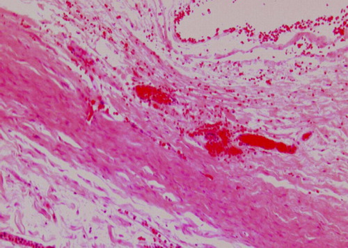 Figure 3.  Conduit group HE staining 4X. Nerve fibers’ course in conduit 6 months operatively (longitudinal section).