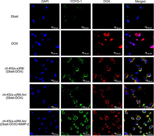 Figure 2. Confocal microscopy images of U251 cells after 3-h incubation with DOX, ch-K5(s-s)R8/(Dbait-DOX) micelles, ch-K5(s-s)R8-An/(Dbait-DOX) micelles, and ch-K5(s-s)R8-An/(Dbait-DOX) micelles + MMP-2. Green fluorescence represents YOYO-1 labeled Dbait, red fluorescence represents DOX, and blue fluorescence represents DAPI-labeled cell nuclei. Scale bar is 5 μm.