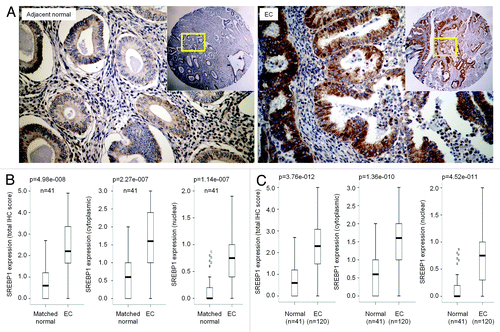 Figure 1. SREBP1 expression in endometrial cancer (EC) determined by IHC. (A) Immunohistochemistry (IHC) staining of endometrial cancer specimens and matched adjacent non-cancerous tissues for SREBP1 protein expression and subcellular localization. (B) Boxplot of IHC staining score for SREBP1 in whole cell, cytoplasm and nucleus in cancer and matched non-cancerous tissues. (C) Boxplot of IHC staining score for SREBP1 in whole cell, cytoplasm and nucleus in all cancer specimens recruited to this study and non-cancerous endometrial tissues.