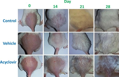 Figure 1 Effect of topical acyclovir on hair growth on different treatment days. BALB/c mice were shaved and received topically applied vehicle or acyclovir for 28 days, the control group did not receive anything (n = 8 for each group). Photographs were taken every week after applying acyclovir or vehicle on the shaved dorsal skin. Less white coloration was observed in acyclovir-treated mice than vehicle and control.
