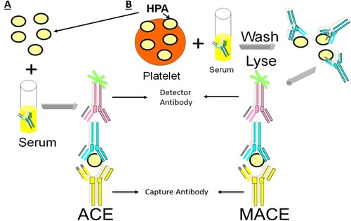 Figure 3 ACE and MACE methods used for capture and identification of patient HPA antibodies. (A) Patient serum is incubated with HPA captured on a plate followed by enzyme-linked antibody for detection. (B) Patient serum is incubated with platelets, washed, lysed, captured and then detected using enzyme-linked antibody.