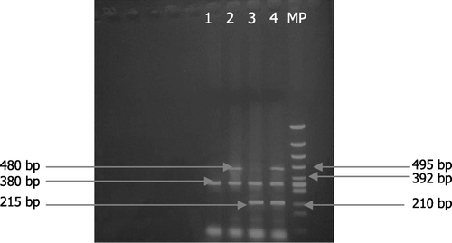 Figure 1.  PCR multiplex for genotyping GSTM1 and GSTT1. Lane 1: GSTM1 null and GSTT1 null; lane 2: GSTM1 null; lane 3: GSTT1 null; lane 4: corresponds to an individual who is positive for both GSTM1 and GSTT1