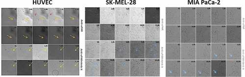 Figure 4. Analysis of Amblyomin-X activity in the migration of cells subjected to uPAR blockade. Cells were incubated with anti-uPAR 1:50 (30 min), followed add of Amblyomin-X (20 μM). The arrows highlight cell extensions and circles emphasize the change in cell morphology. Movies are available in the supplementary material.