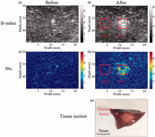 Figure 3. Ultrasonic B-mode, Δα0 and tissue section images of the thermal lesion in an in vivo porcine liver immediately after MWA. Regions of interest are 4 × 4 mm.